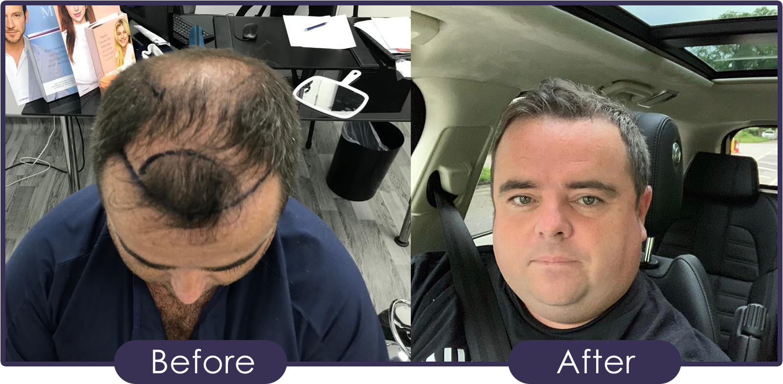 Hair Clinic Before & After